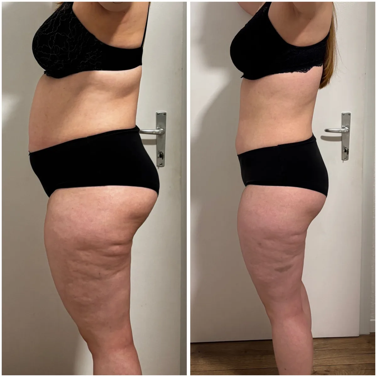 Vorher-Nachher Teilnehmerin, minus 10 Kilo